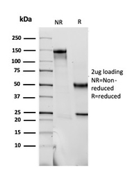 S100 beta antibody [SPM354]