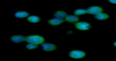 Aldolase C antibody [AT2E11]