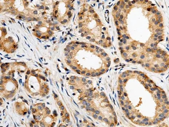 Carbonic Anhydrase XII antibod