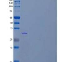 人前脑啡肽A原（Proenkephalin-A）重组蛋白C-6His