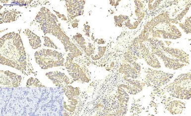 ABCB5 antibody [11A2]