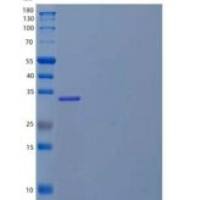 人妊娠特异性β1-糖蛋白2(PSG2)重组蛋白C-6His