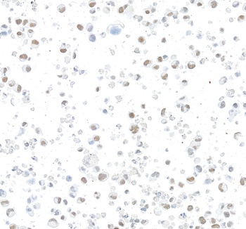 ARID1B Antibody 抗体，orb1806438，