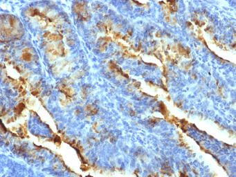 FSH Receptor antibody [FSHR/14