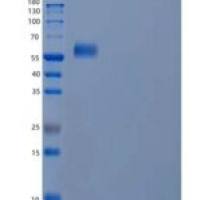 人泛素关联蛋白1/NAG20(UBAP1)重组蛋白C-6His
