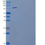 小鼠基质金属蛋白酶9(MMP9)重组蛋白