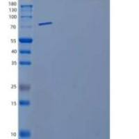 小鼠基质金属蛋白酶9(MMP9)重组蛋白