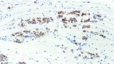 Mesothelin antibody [5B2]