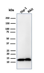 beta 2 Microglobulin antibody 