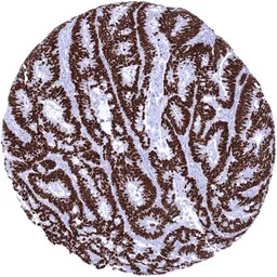 SATB2 antibody [MSVA-702R] His