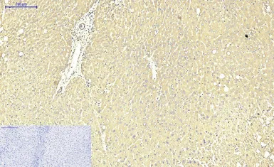 ABCB5 antibody [11A2]