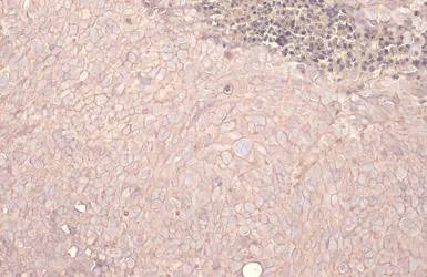 EpCAM antibody [HL1338]