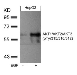 AKT (phospho Tyr315) antibody