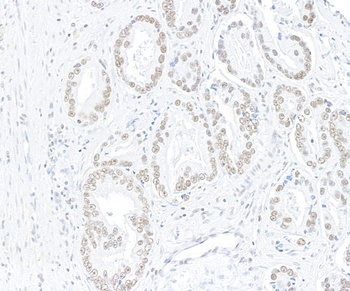 ARID1A/BAF250 Antibody 抗体，orb1