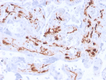 Factor XIIIa antibody [F13A1/3