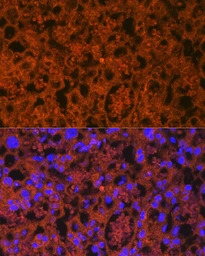 PLGF antibody [GT1358]