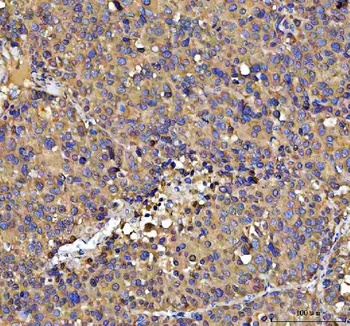 Anti-NUBPL Antibody 抗体，orb1786