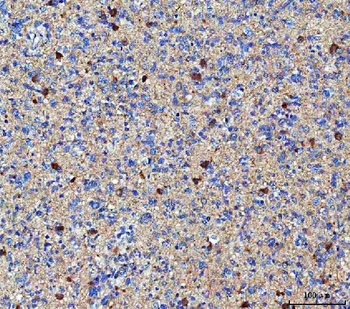 Anti-MGAT4B Antibody 抗体，orb174