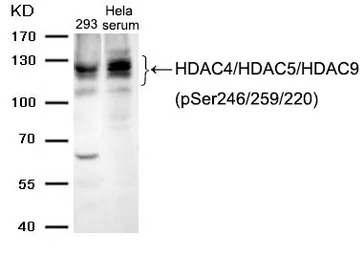 HDAC4 (phospho Ser246) + HDAC5