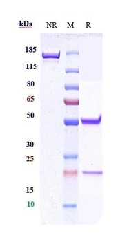 Anti-CEACAM5 / CEA / CD66e Ref