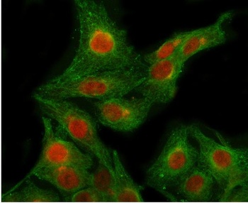 Anti-POLR2B Antibody 抗体，orb178