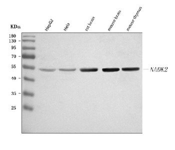 C5orf33/NADK2 Antibody 抗体，orb1