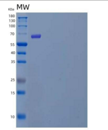 人POMGNT1重组蛋白C-6His