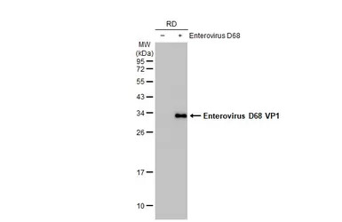 Enterovirus D68 VP1 antibody [