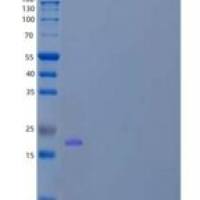 人EIF1A，X染色体/EIF1AX重组蛋白N-6His