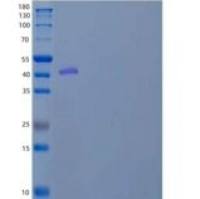 小鼠纤溶酶原激活物抑制剂1/PAI-1/丝氨酸蛋白酶抑制剂E1重组蛋白C-6His