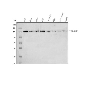 Anti-POLR2B Antibody 抗体，orb178