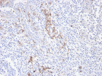 CD38 antibody [CD38/4247R]