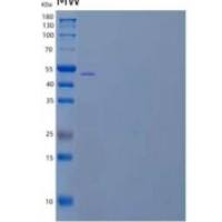 小鼠含有丛蛋白结构域的蛋白2/PLXDC2重组蛋白C-6His