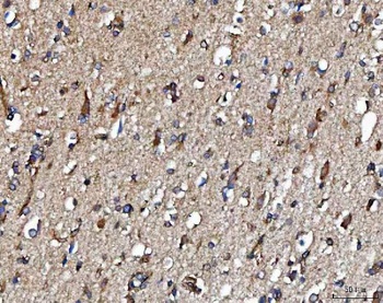 Anti-METAP2 Antibody 抗体，orb178