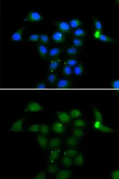 Tyrosine Aminotransferase anti