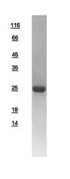 Human RAB2B protein, His tag