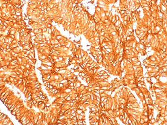 EpCAM antibody [EGP40/1556R]
