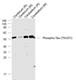 Tau (phospho Thr231) antibody