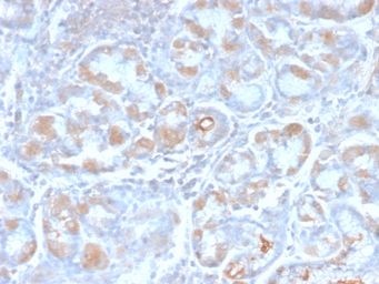 TFF1 antibody [TFF1/2969R]