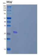 人含锌指MYND结构域的蛋白19/ZMYND19重组蛋白N-