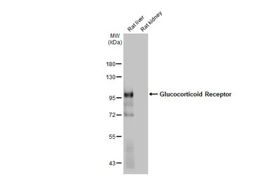 Glucocorticoid Receptor antibo