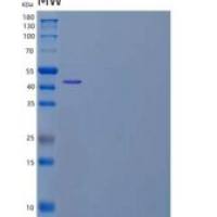 人ERO1样蛋白α/ERO1L重组蛋白C-6His