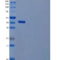 人白介素22(IL22)重组蛋白C-hIgG2 Fc
