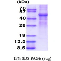 Human GSK3 beta protein, His t