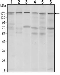 SETDB1 antibody [5H6D4]