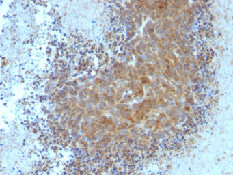 Bax antibody [BAX/962]