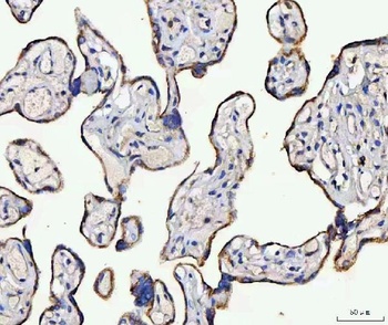 Anti-MCCC2 Antibody 抗体，orb1786