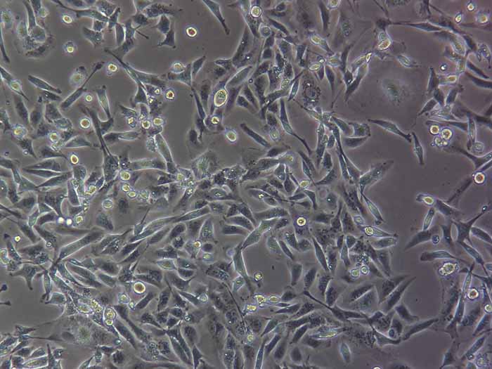 MDA-MB-231人乳腺癌细胞(STR鉴定正确)