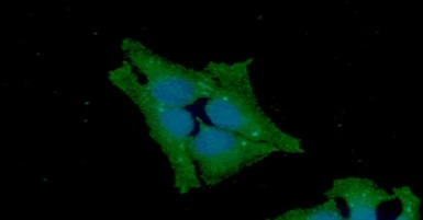 GSS antibody [AT12F2]