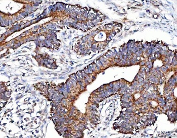 Anti-MCCC1 Antibody 抗体，orb1786